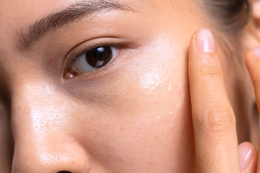 Is It Purging or Is Your Skin Overwhelmed? Here's How to Tell